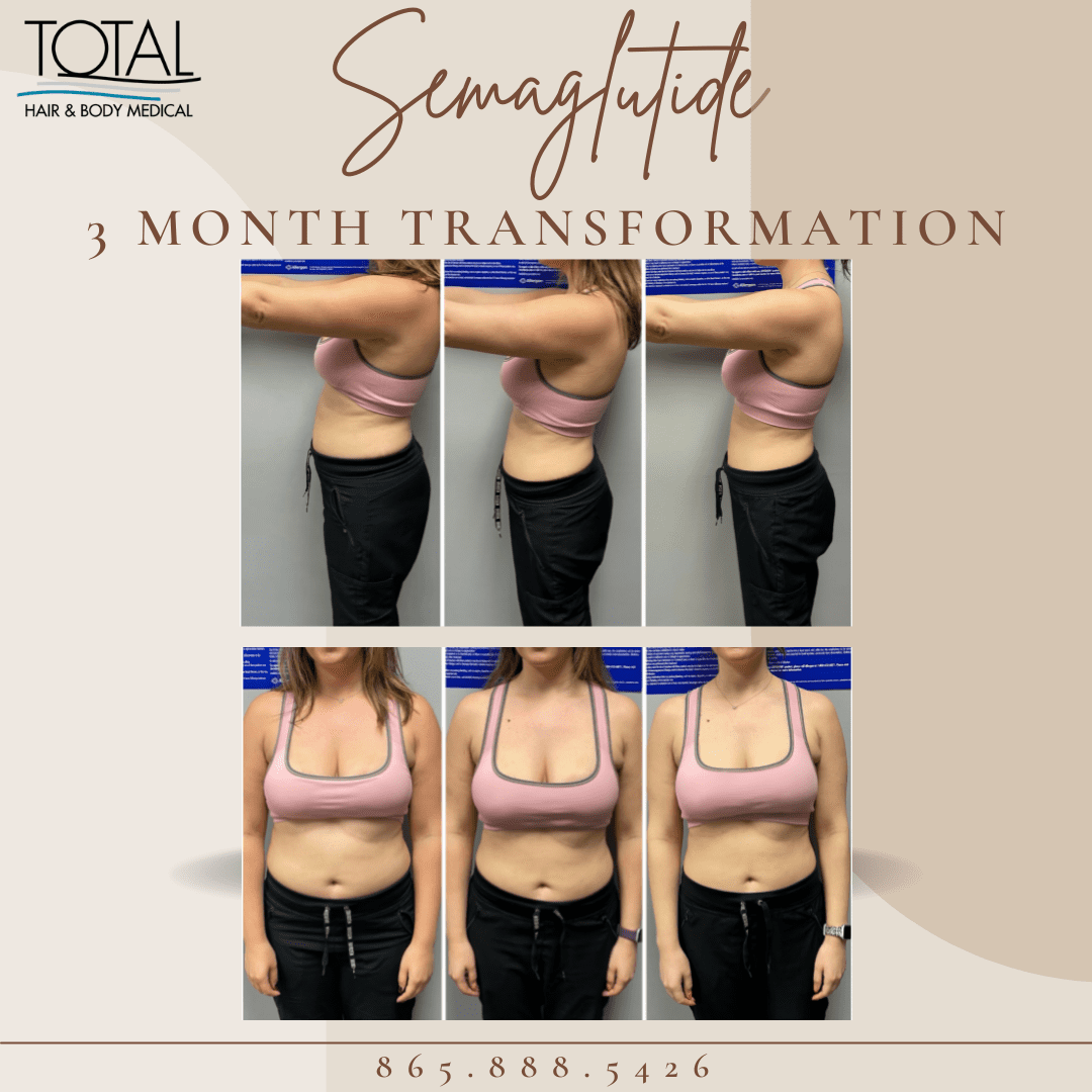 Look Slimmer Instantly Without Dieting – Adjustable Waist Trimmer Belt
